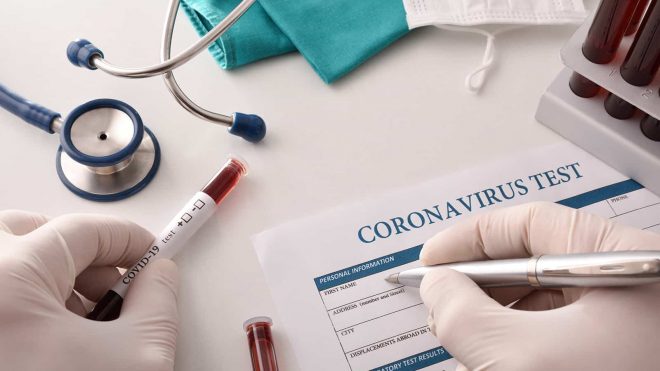COVID-19 latest: Cases rise to 12 074, deaths increase by 13