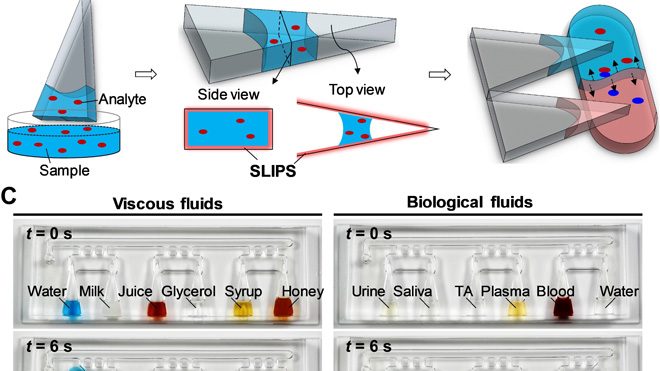 SLIPS-LAB—A bioinspired bioanalysis system for metabolic evaluation of urinary stone disease