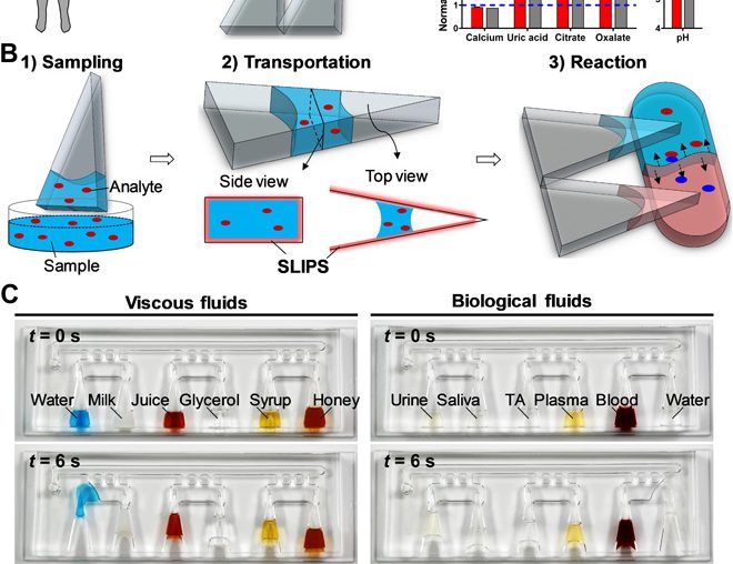SLIPS-LAB—A bioinspired bioanalysis system for metabolic evaluation of urinary stone disease