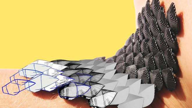 This wearable cast revolutionizes healthcare by protecting and healing injuries without sacrificing mobility!